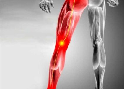 الحجامة ل عرق النساء و الولادة